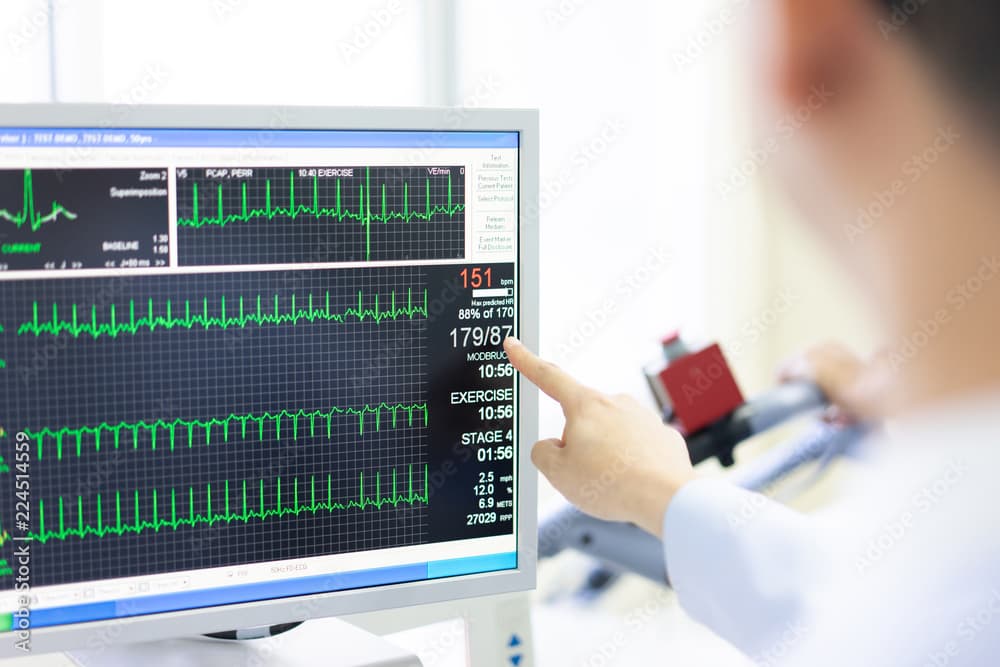 Elektrokardiyografi (EKG) Çekimi